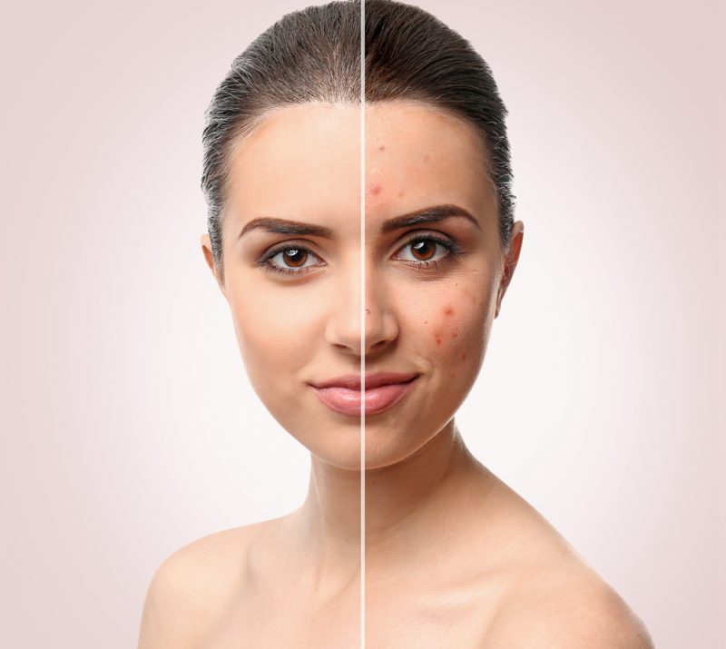 კოლაგენი